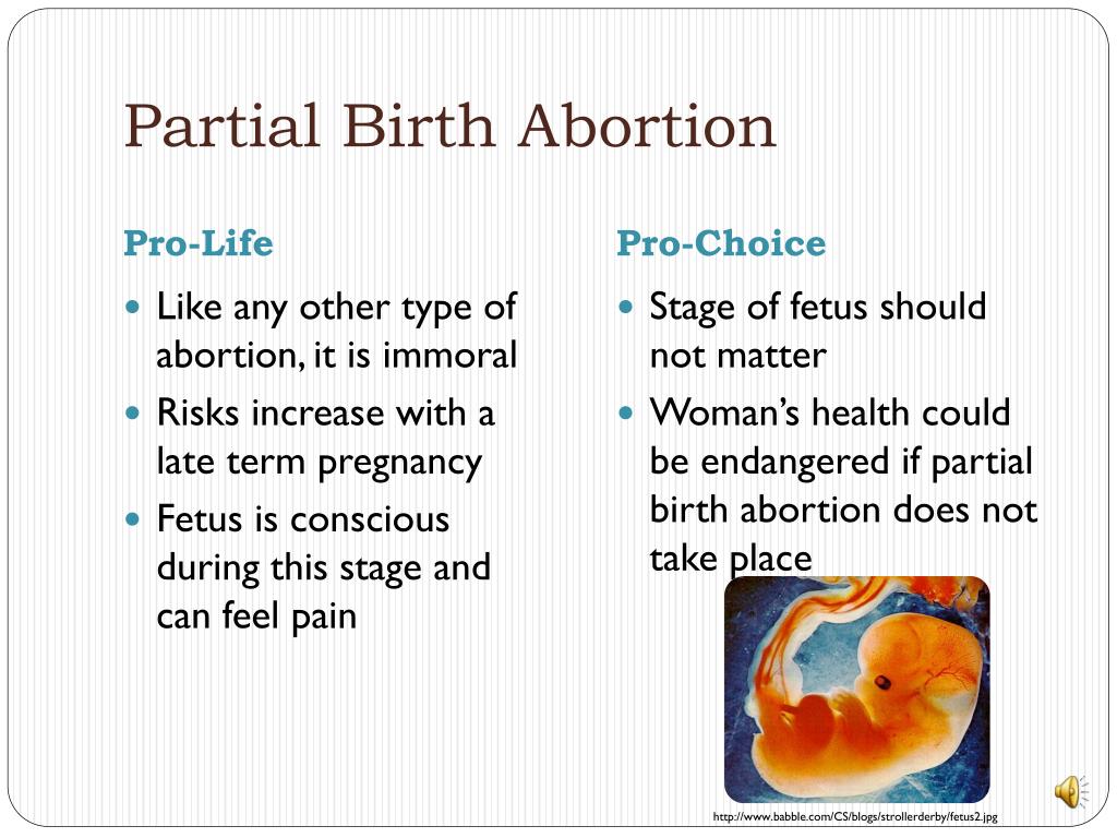 Реферат: Partial Birth Abortion Mercy Or Infanticide Essay
