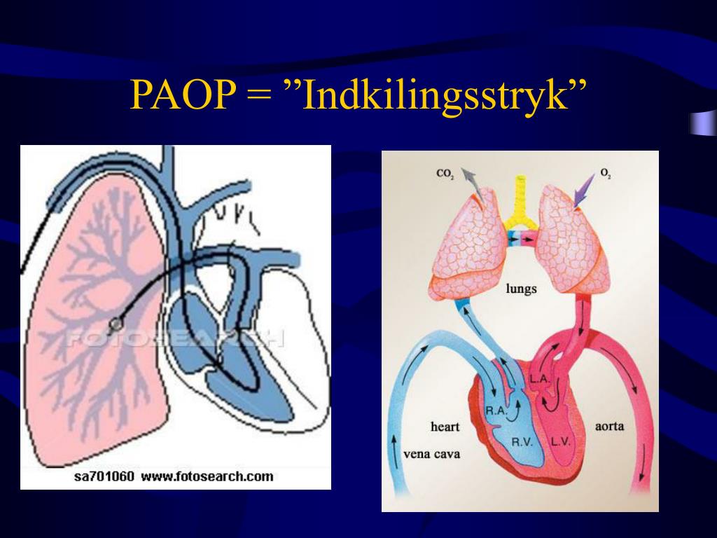 PPT - Hæmodynamik ved sepsis PowerPoint Presentation, free download ...