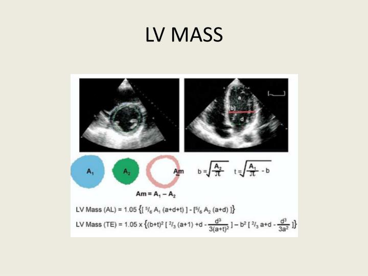 PPT - EVALUATION OF SYSTOLIC FUNCTION OF LEFT VENTRICLE BY ECHOCARDIOGRAPHY PowerPoint ...