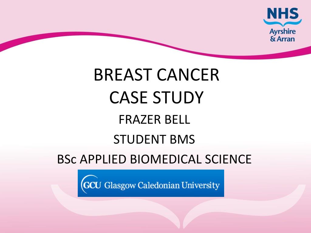 breast cancer case presentation slideshare