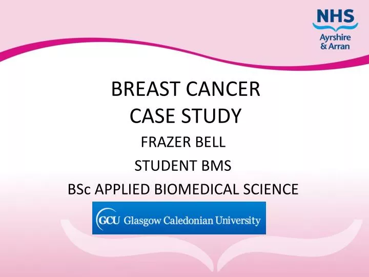 case study of breast cancer ppt