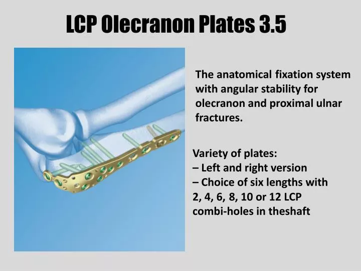 lcp olecranon plates 3 5 n.
