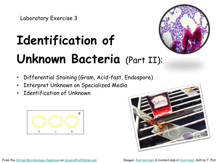 unknown bacteria identification hypothesis I usually go in and wing it hoping for a result that will support my hypothesis identifying the unknown bacteria i was assigned unknown bacterial. unknown bacteria identification hypothesis I usually go in and wing it hoping for a result that will support my hypothesis identifying the unknown bacteria i was assigned unknown bacterial.