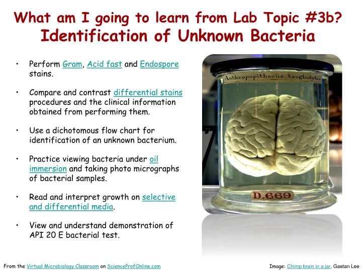 techniques for identifying an unknown bacteria This virtual lab will familiarize you with the science and techniques used to identify different types of bacteria based on their dna sequences. techniques for identifying an unknown bacteria This virtual lab will familiarize you with the science and techniques used to identify different types of bacteria based on their dna sequences.