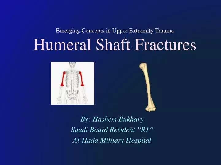 emerging concepts in upper extremity trauma humeral shaft fractures n.