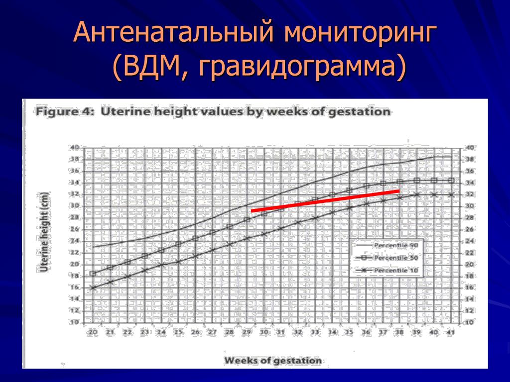 Высота дна матки. Гравидограмма ВДМ. Гравидограмма измерение ВДМ. Высота стояния дна матки Гравидограмма. Заполнение гравидограммы.