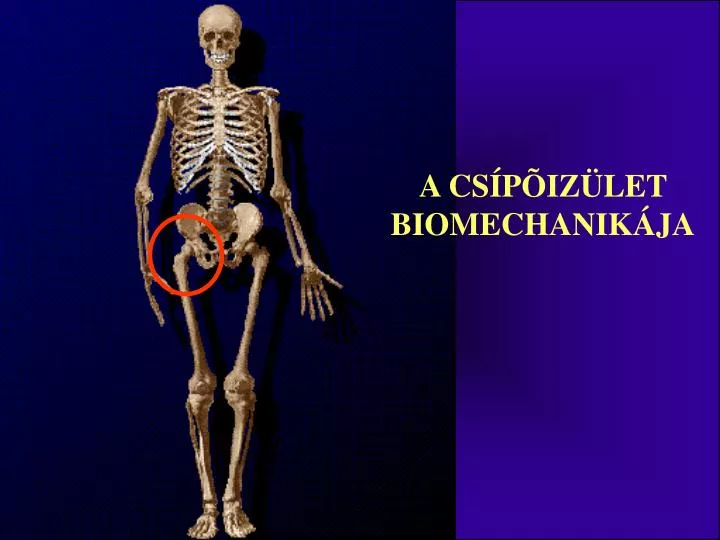 Csípőízület 3. fokú csontritkulása, Csontritkulás okai, kivizsgálása, kezelése - Endokrinközpont