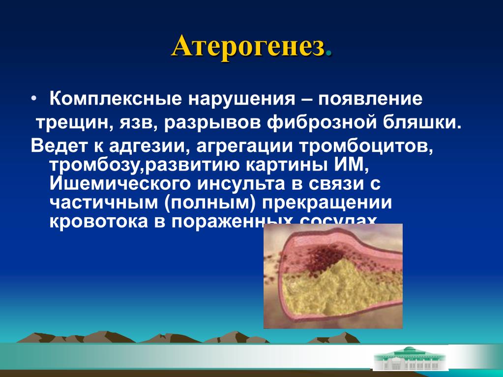 Комплексные нарушения. Атерогенез. Атерогенез презентация. Современные концепции атерогенеза.