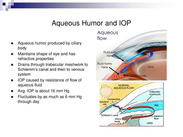 PPT - Glaucoma PowerPoint Presentation - ID:5096621