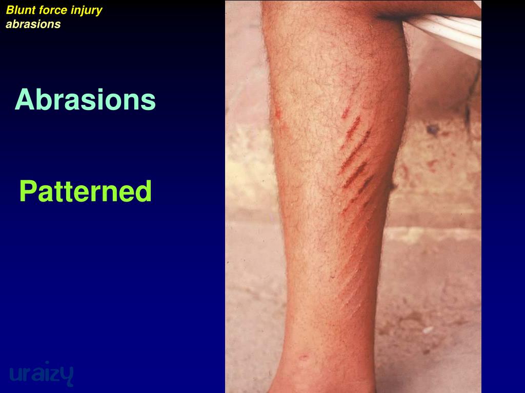 PPT Traumatology PowerPoint Presentation, free download ID5102882