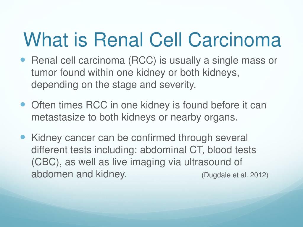 Ppt Treatment Options For Renal Cell Carcinoma Powerpoint