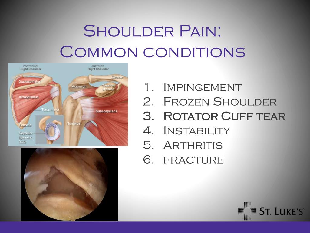Shoulder Injuries Anatomy