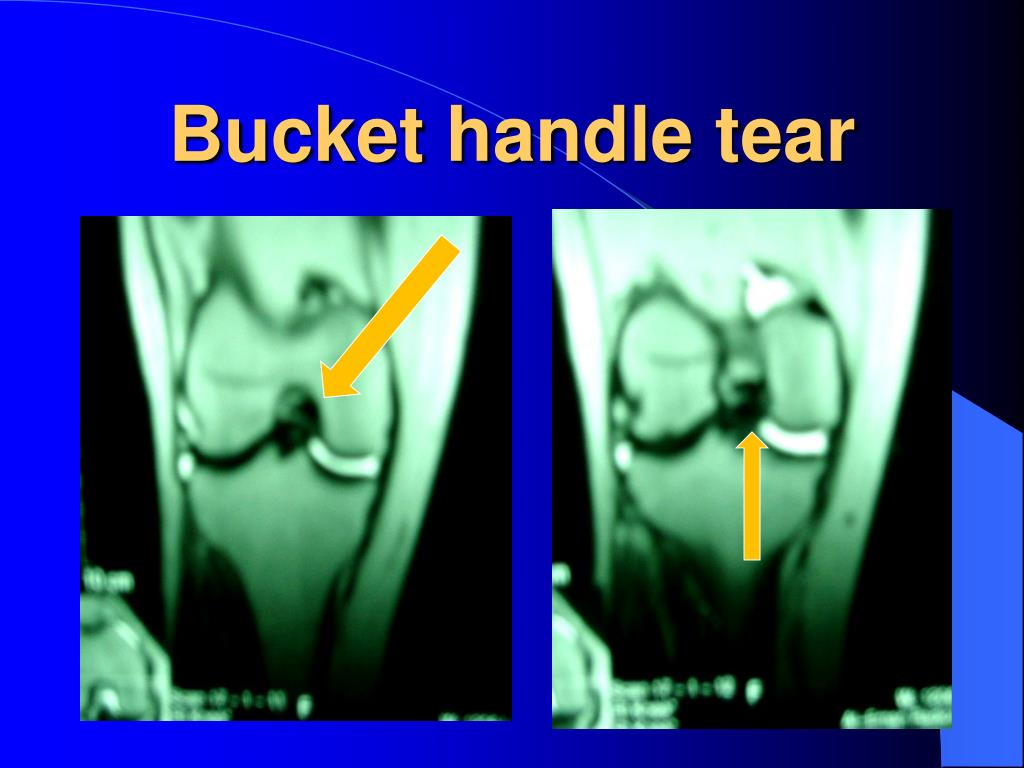 PPT MRI KNEE ORTHOPEDIC APPROACH PowerPoint Presentation Free PPT MRI KNEE ORTHOPEDIC APPROACH PowerPoint Presentation Free