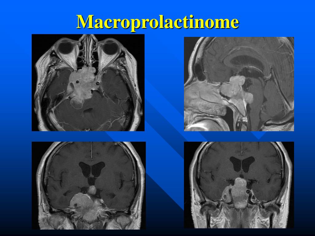 PPT NEUROCHIRURGIE ET NERFS CRANIENS PowerPoint Presentation Free PPT NEUROCHIRURGIE ET NERFS CRANIENS PowerPoint Presentation Free