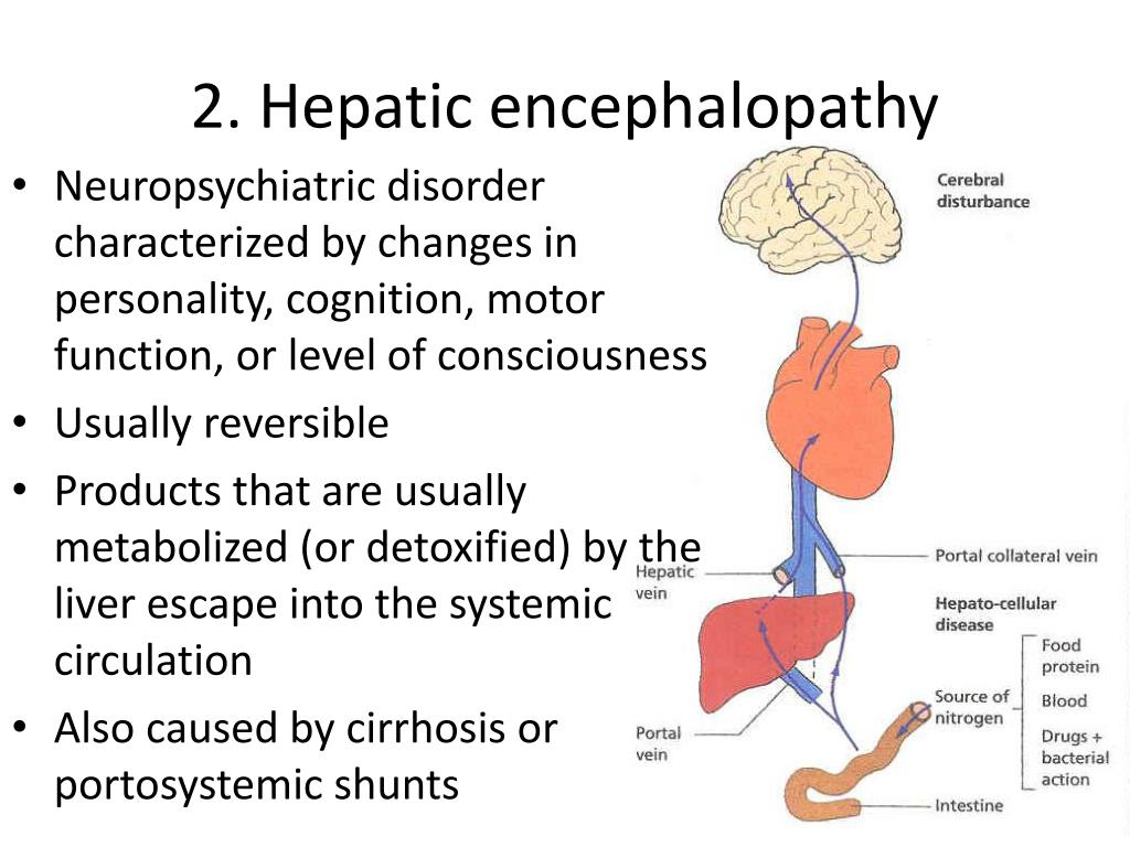 PPT - LIVER CIRRHOSIS AND ITS COMPLICATIONS PowerPoint Presentation ...