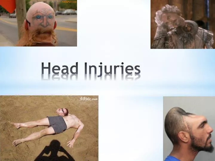 head injuries n.