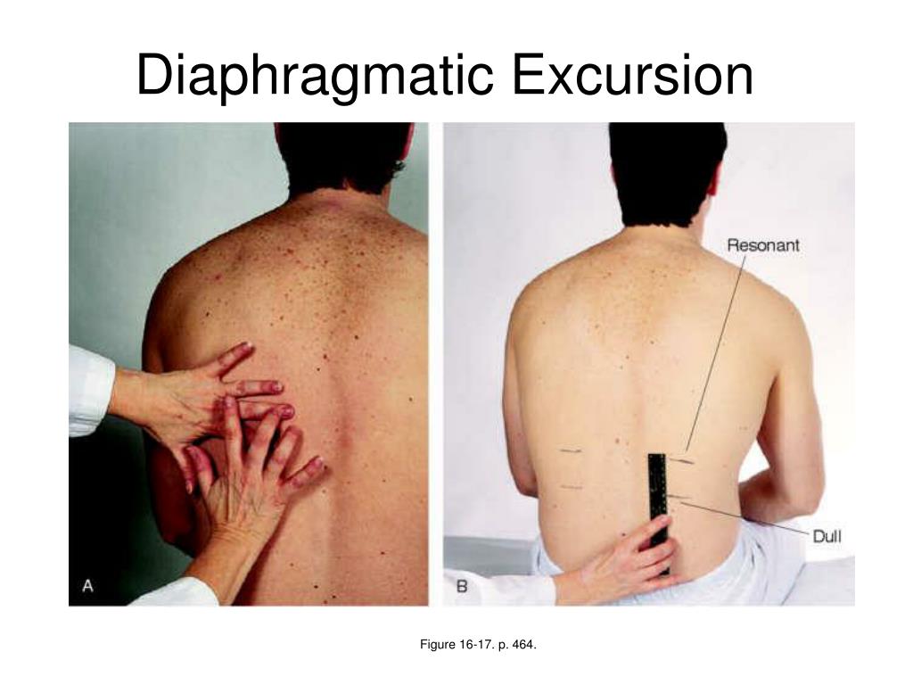 diaphragmatic excursion traduccion