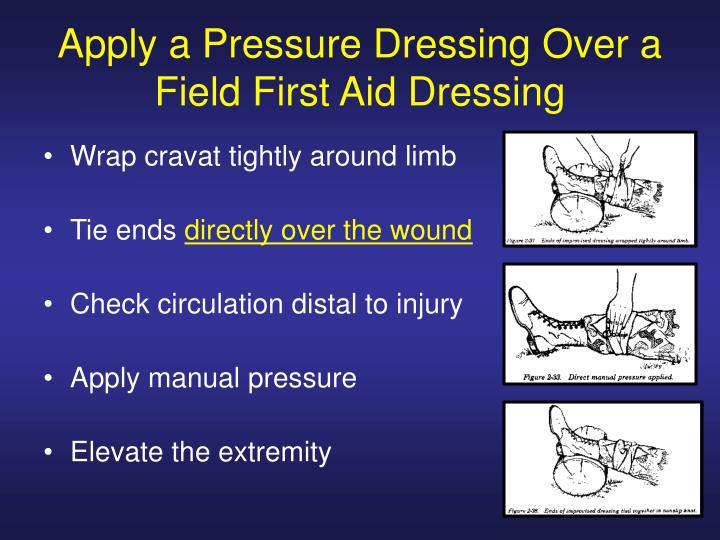 PPT Controlling Bleeding PowerPoint Presentation ID5170566