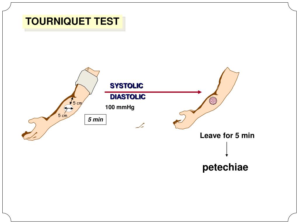 PPT Laboratory Approach to Patient with Bleeding (Hemostasis PPT Laboratory Approach to Patient with Bleeding (Hemostasis