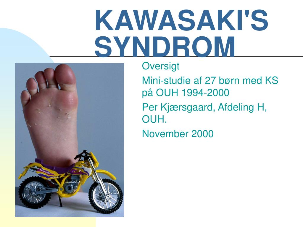 underviser Tåget reform PPT - KAWASAKI'S SYNDROM PowerPoint Presentation, free download - ID:5178270