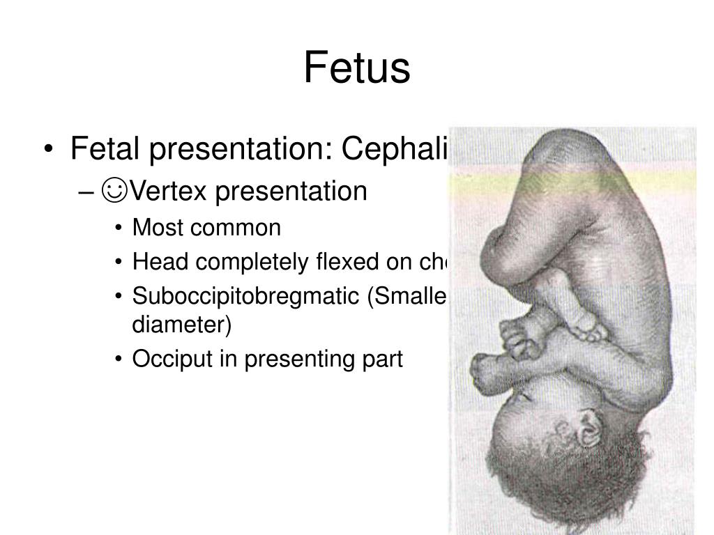 baby presentation ceph