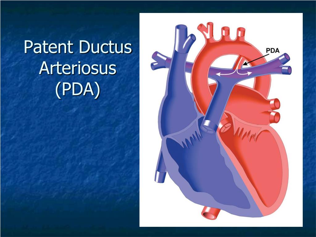 PPT - Adult Congenital Heart Disease PowerPoint Presentation, free ...