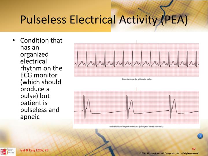 Pulseless electrical activity treatment lufilo