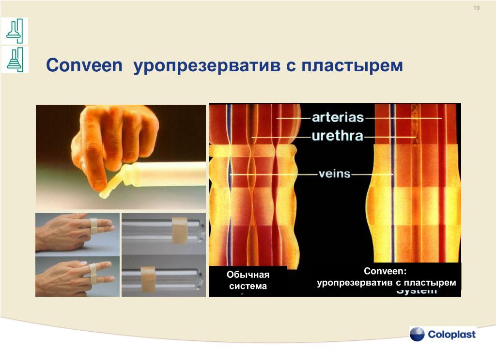 Обычная система. Уропрезерватив презентация. Продукция компании Coloplast презентация. Уропрезерватив с пластырем для чего.