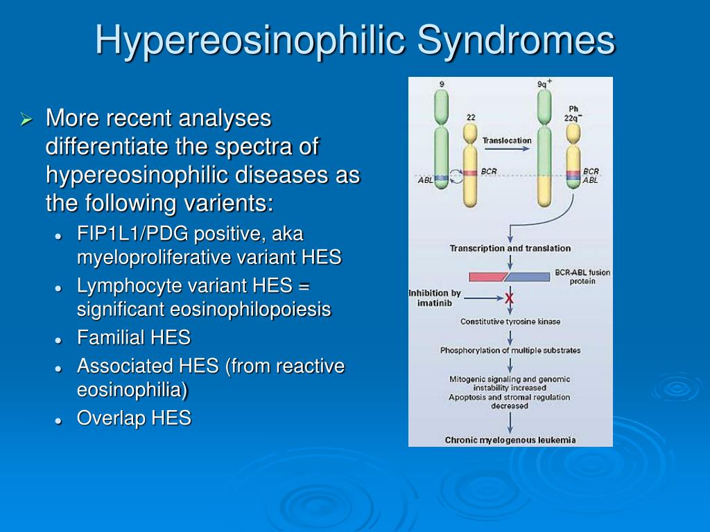 Causes Of Hypereosinophilia | Hyperéosinophilie : quelles causes, quel ...