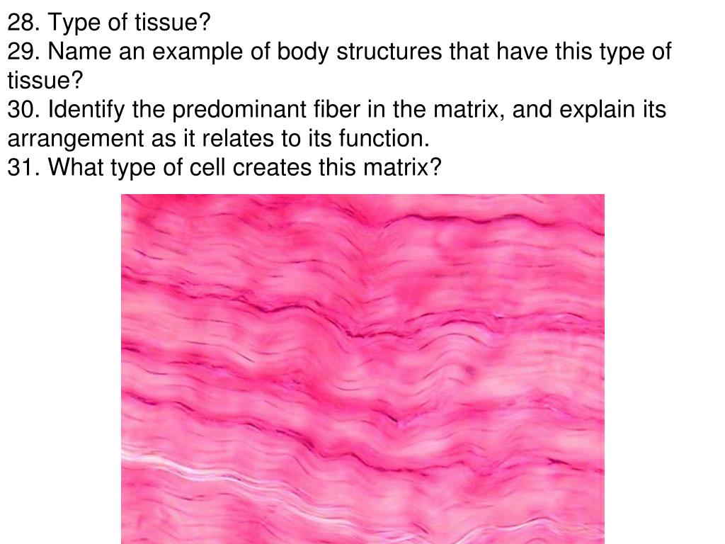 PPT - What type of tissue is indicated by the blue arrow ... PPT - What type of tissue is indicated by the blue arrow ...