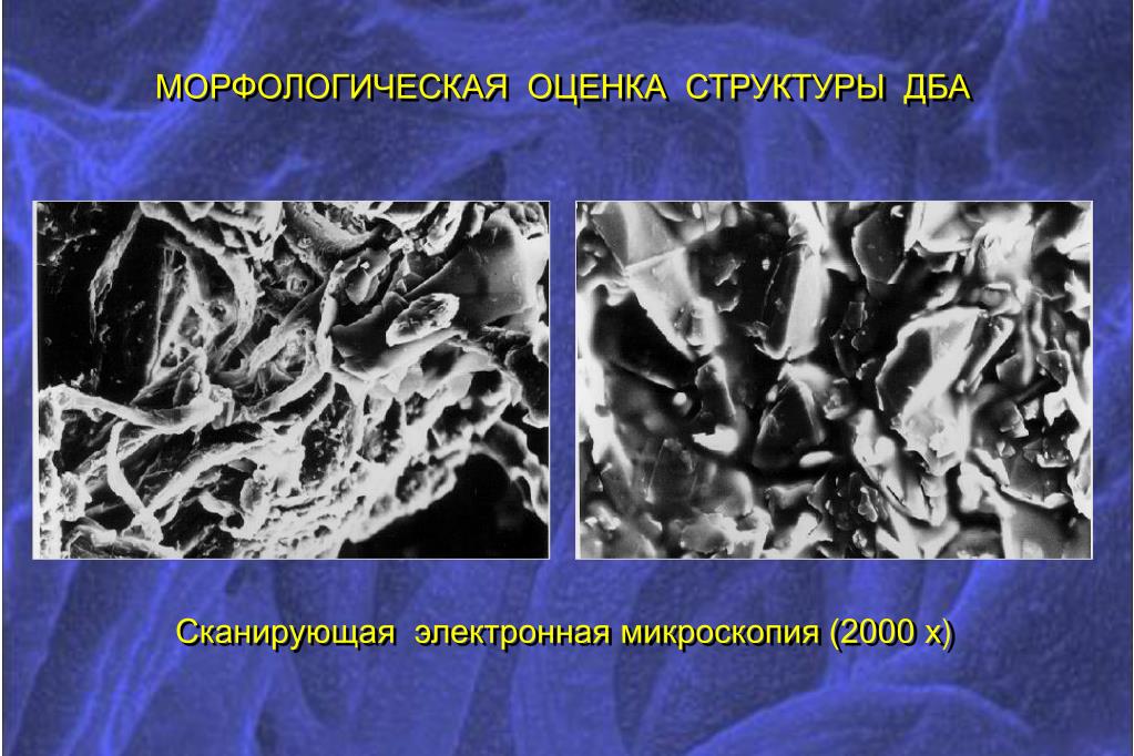 Оценка структур. Коллаген сканирующая электронная микроскопия. Структура пластика на электронном микроскопе. Узел требующий морфологической оценки. Аллоплант ретроскломбирование васкулогенез.