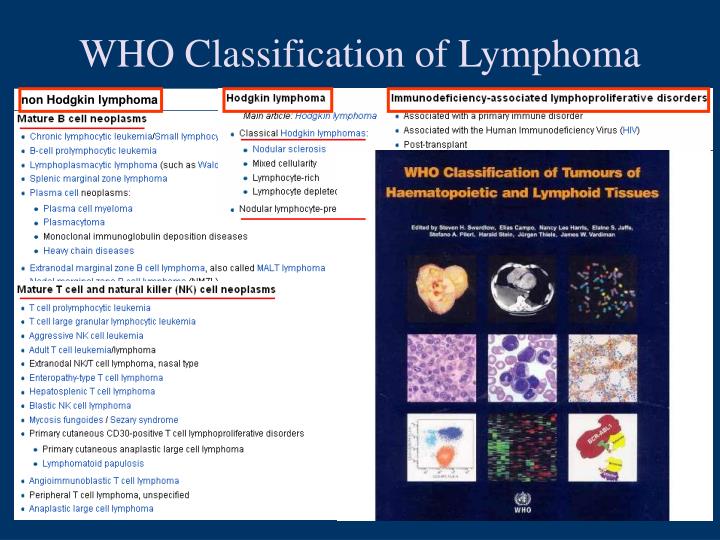 Lymphoma Facts City Of Hope