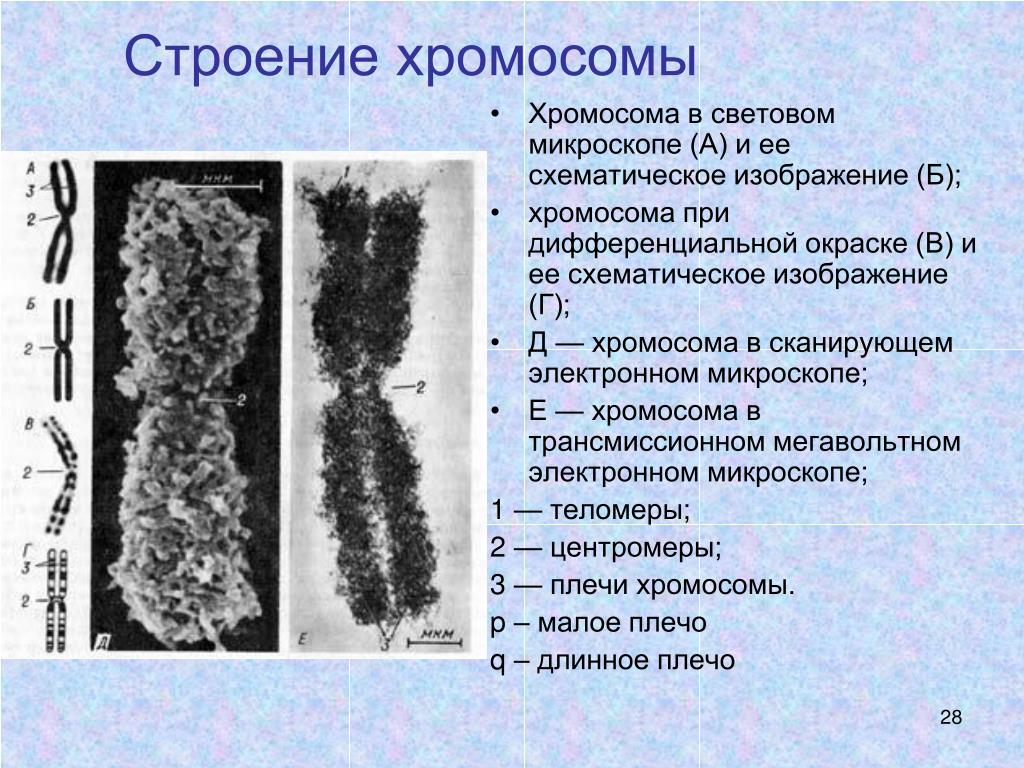 Хромосомы лучше видны. Строение хромосом в световом и электронном микроскопах. Строение хромосомы. Схематическое строение хромосомы. Хромосомы в электронном микроскопе.