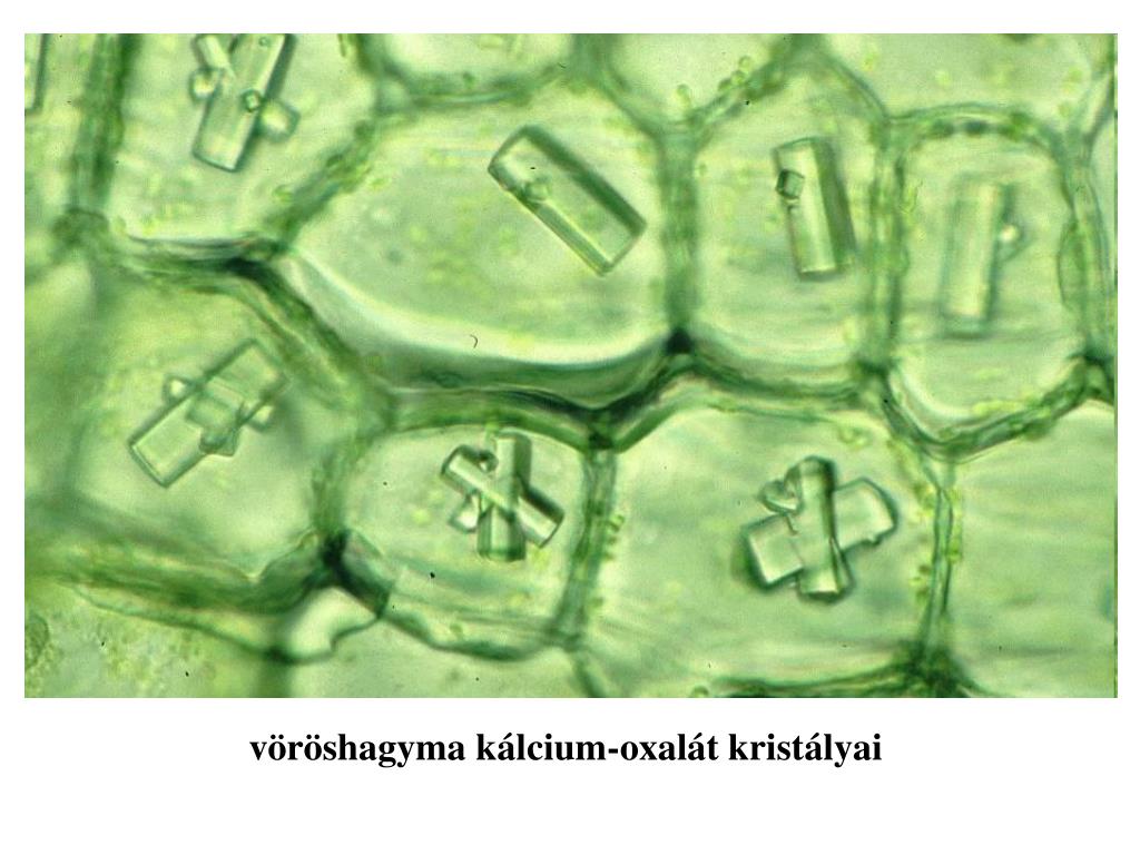 Клетка листа бегонии. Кристаллы щавелевокислого кальция в вакуолях клеток.