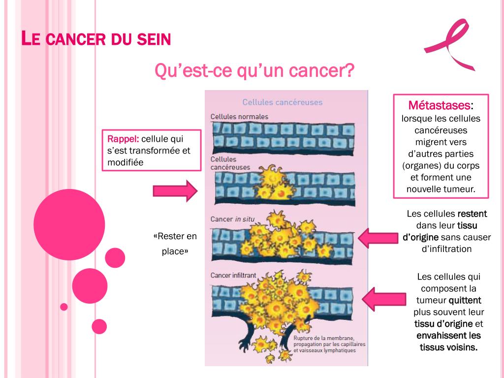 presentation powerpoint cancer du sein