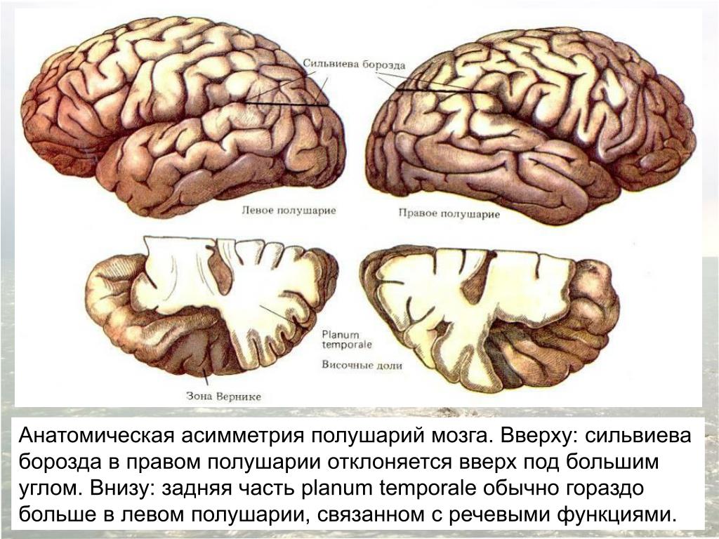 Левая гемисфера головного мозга. Сильвиева борозда головного мозга. Роландова борозда и сильвиева борозда. Анатомия плода сильвиева борозда. Сильвиева борозда мозга анатомия.