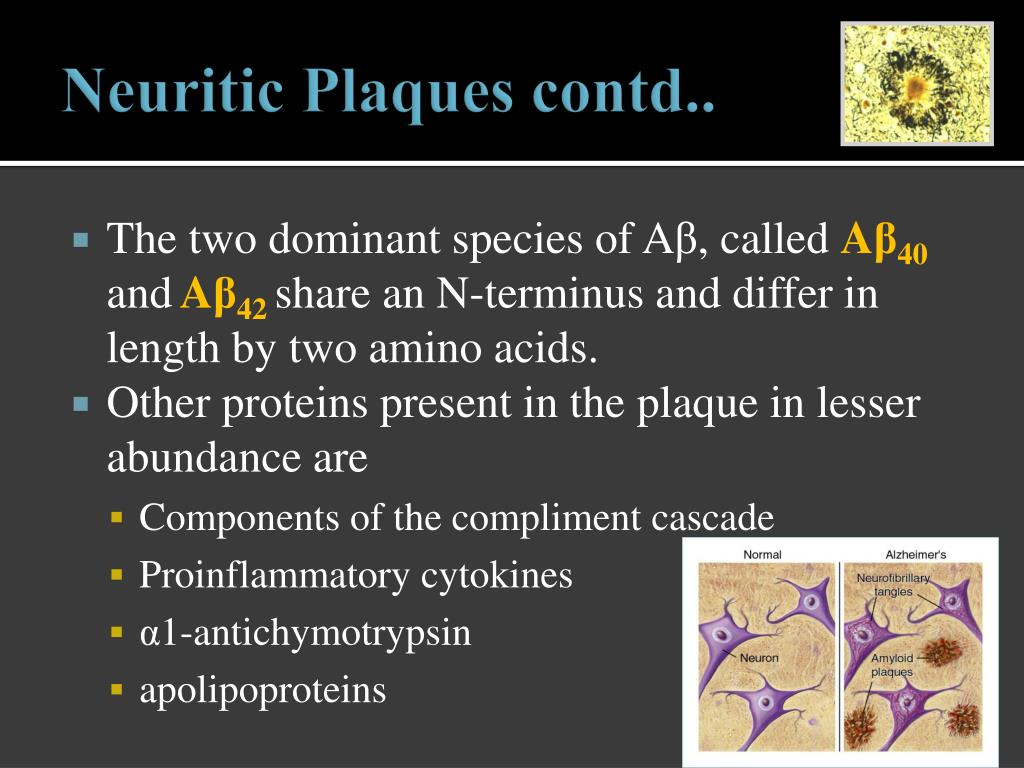 Neuritic Plaques In Alzheimer's Disease Are Composed Of at Ronald Rooks