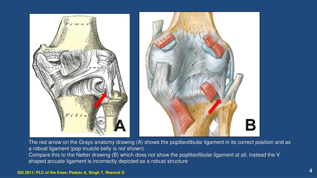 PPT - Posterolateral Corner of the Knee: MRI, Anatomy, Functional