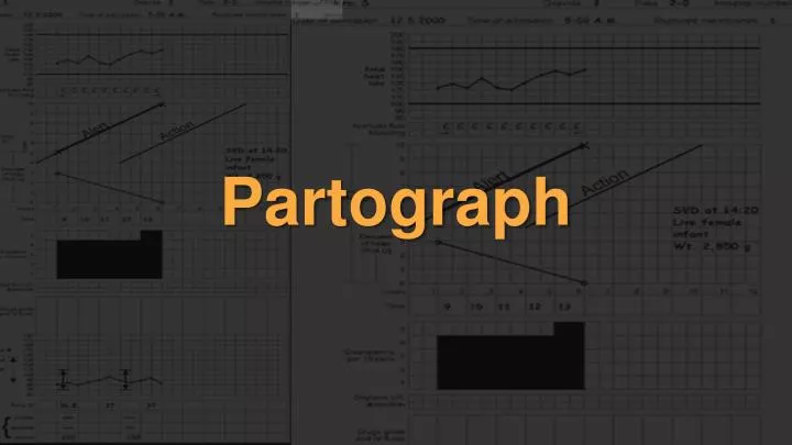 Partograph Chart Download