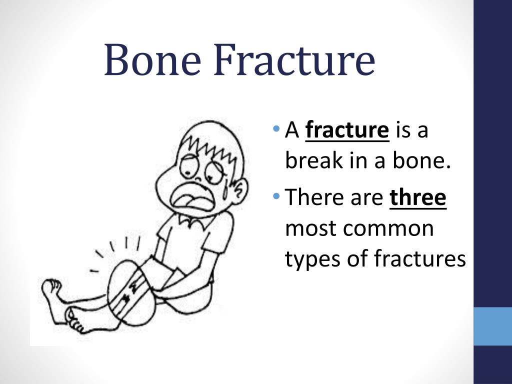 bone fracture vs break