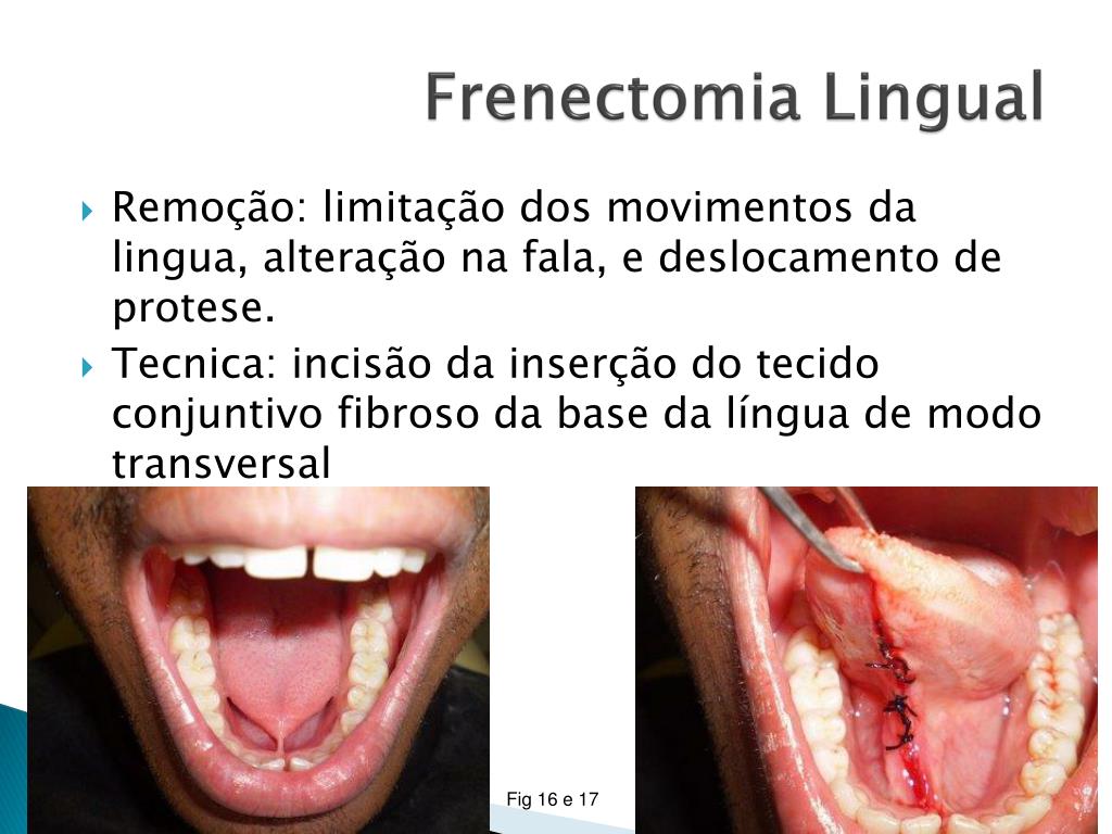 PPT Cirurgia Pr prot tica PowerPoint Presentation Free Download PPT Cirurgia Pr prot tica PowerPoint Presentation Free Download