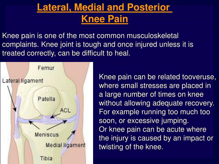 PPT Lateral, Medial and Posterior Knee Pain PowerPoint Presentation