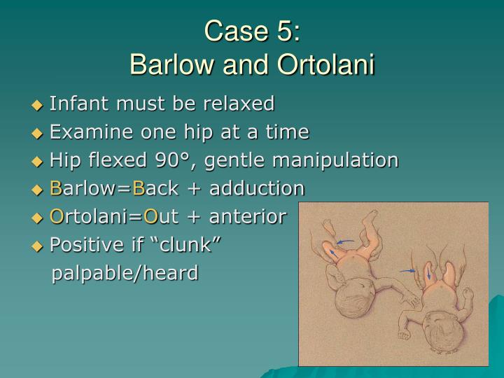 PPT Neonatal Orthopedic Issues PowerPoint Presentation ID5335544