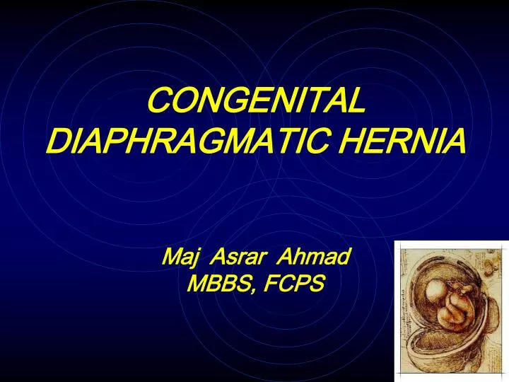 hernia ppt file