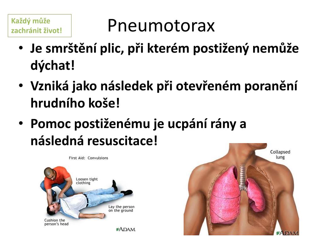 PPT - Dýchání PowerPoint Presentation, free download - ID:5352727
