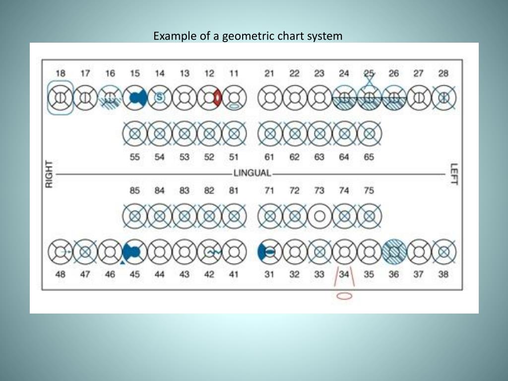 Dental Charting Symbols Quiz Best Picture Of Chart Anyimage Org