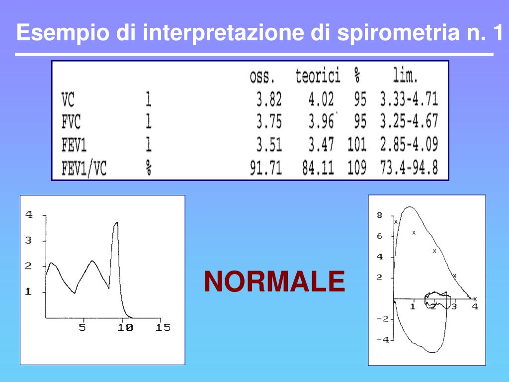 PPT - LEZIONI DI FISIOPATOLOGIA RESPIRATORIA PowerPoint Presentation, free  download - ID:5370440