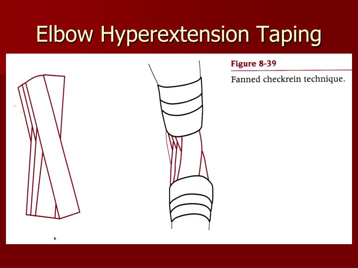 PPT Chapter 8 Bandaging and Taping PowerPoint Presentation ID5371096
