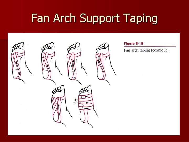 PPT Chapter 8 Bandaging and Taping PowerPoint Presentation ID5371096